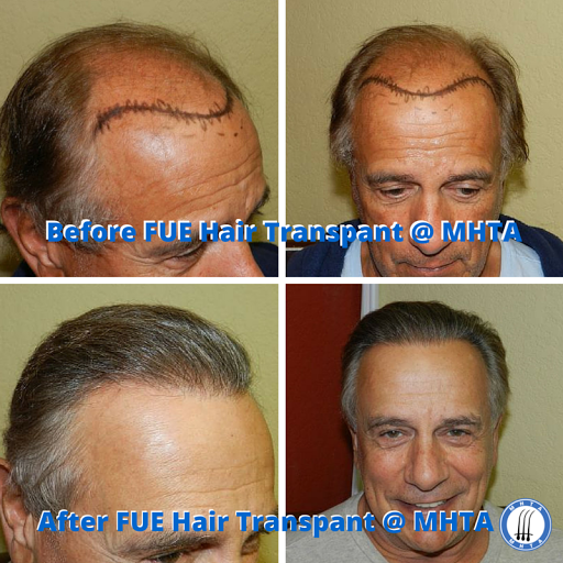 Hair Replacement Service «Medical Hair Transplants & Aesthetics», reviews and photos, 15055 Los Gatos Blvd Suite #110, Los Gatos, CA 95032, USA