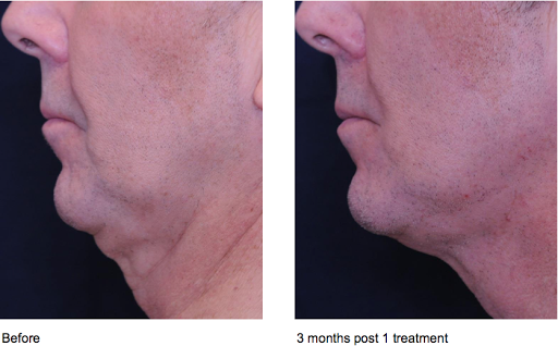 Fakheri Azita MD - Dermatologist in Tarzana image