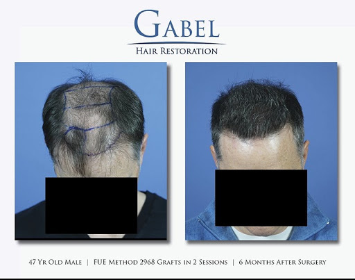 Plastic Surgeon «Gabel Center», reviews and photos, 900 SE Oak St #203, Hillsboro, OR 97123, USA