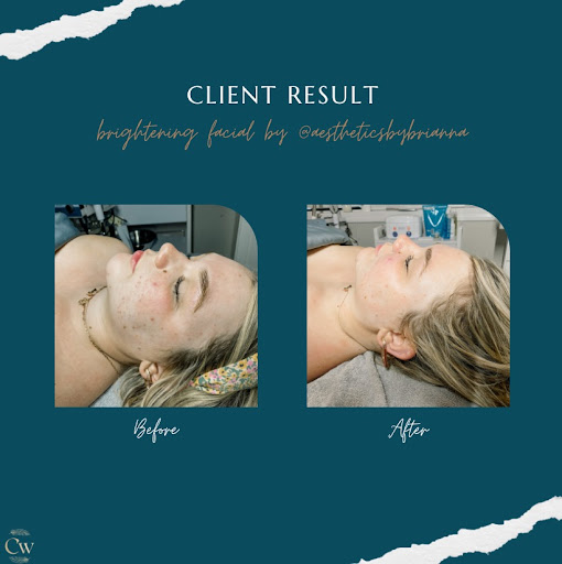 Explore cannabis tattoo ideas, creative tattoo ideas in Bristol, available at Cliffwood Medical Aesthetics and Wellness