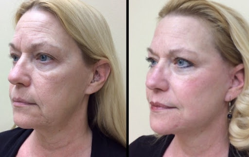 Explore design tattoo ideas for men small, creative tattoo ideas in Sterling Heights, available at Skin & Vein Center