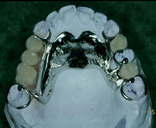 Opiniones de Reparación de prótesis dental a domicilio en Cerro Navia - Laboratorio
