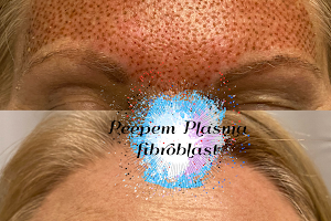 Peepem Plasma Fibroblast image