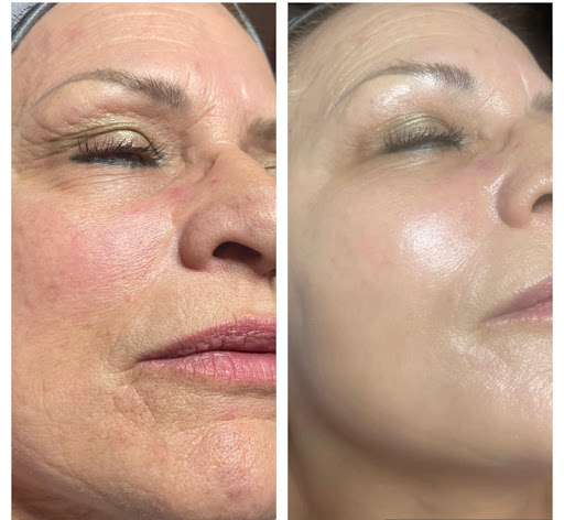 Explore march tattoo ideas, creative tattoo ideas in Eugene, available at Absolute Laser MD