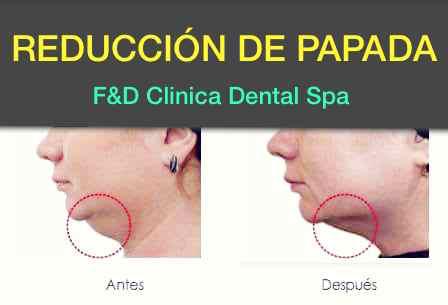 Dra.Dennise Peña Mero "Clínica Dental & Estética" - Dentista