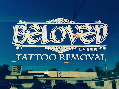 Beloved Laser Tattoo Removal