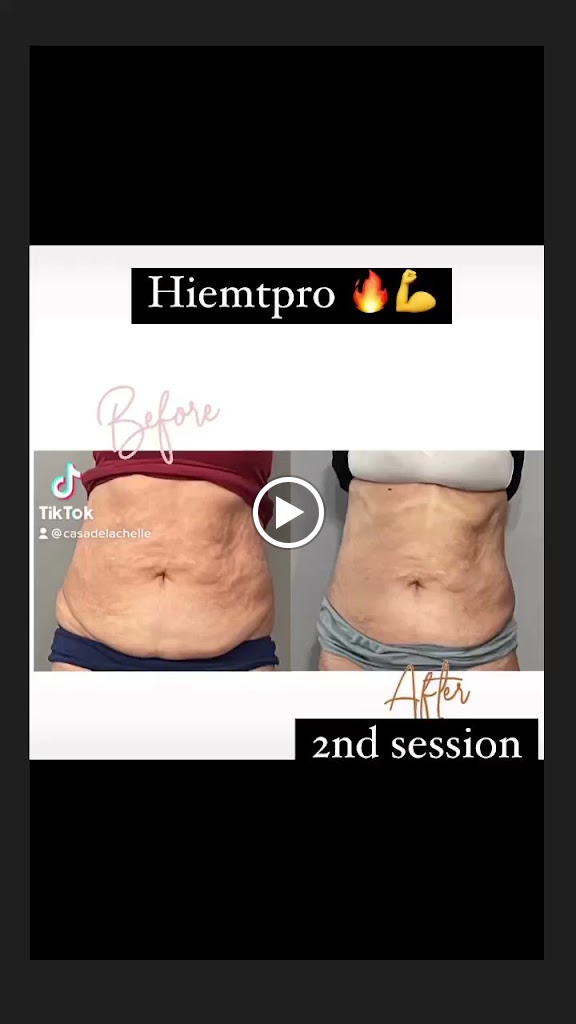 Casa de la Chelle 10958