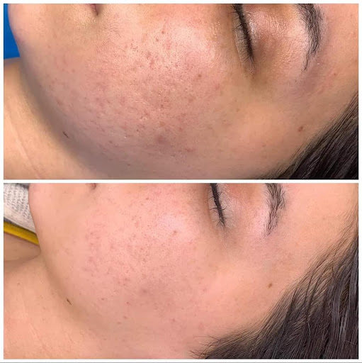 Explore anxiety mental health tattoo ideas, creative tattoo ideas in Savannah, available at Haute Brows. Cosmetic Tattoo