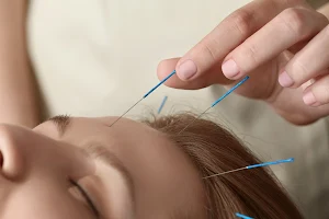 AURORA SALUD-Clinica de acupuntura y terapias orientales image
