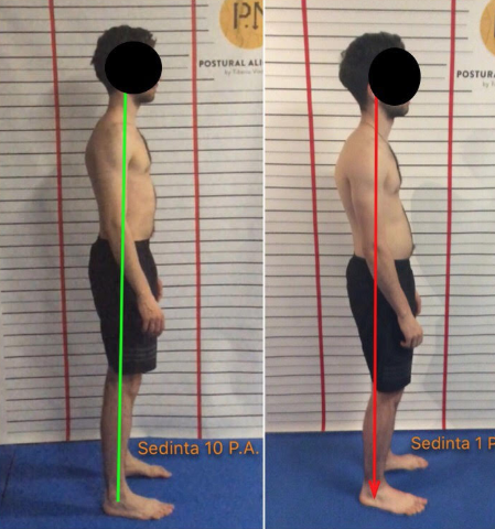 Postural Alignment