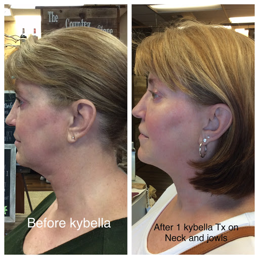 Explore harry potter tattoos ideas, creative tattoo ideas in Eugene, available at Brighter Smiles Med Spa and Laser Center