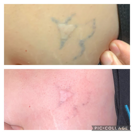 Explore small initial tattoo ideas, creative tattoo ideas in Lake Dallas, available at Restore YOUth Med Spa