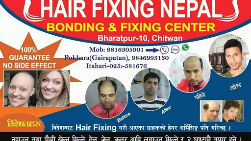Hair fixing Nepal - Hair Replacement Service in rod