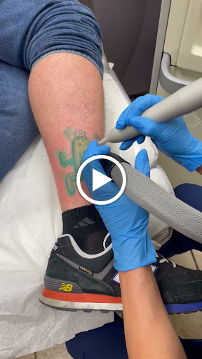 Explore fork tattoo ideas, creative tattoo ideas in Middle Village, available at Bye Bye Ink Laser Tattoo Removal