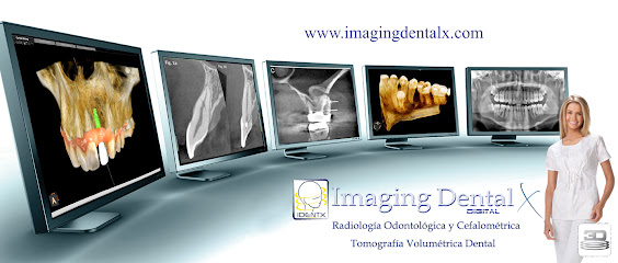 Imaging Dental Digital X