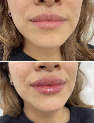 Explore 999 tattoo ideas, creative tattoo ideas in Owensboro, available at The Skin Lab