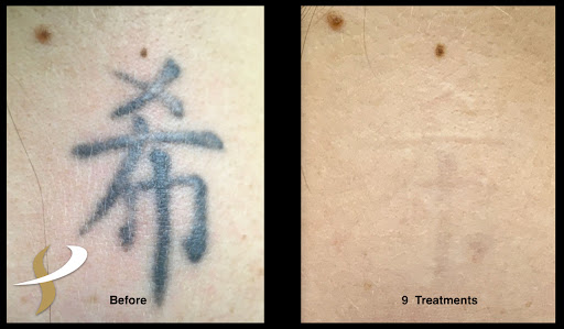 Explore mens ring tattoo ideas, creative tattoo ideas in Spokane, available at Premier Body and Laser