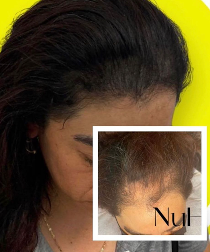 Explore partial sleeve tattoo ideas, creative tattoo ideas in Roseville, available at NuHair Ink. Scalp MicroPigmentation & Aesthetic Clinic of Sacramento