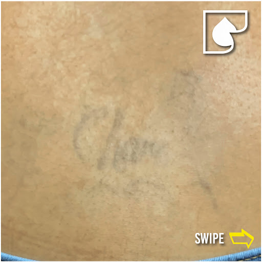 Explore king tattoo ideas, creative tattoo ideas in South Gate, available at Tattoo Removal Inc