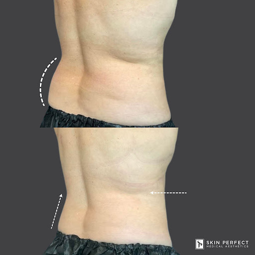 Explore ideas for initial tattoos, creative tattoo ideas in Whittier, available at Skin Perfect Medical Aesthetics