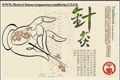 Morley Chinese Acupuncture & Herbs - Leeds