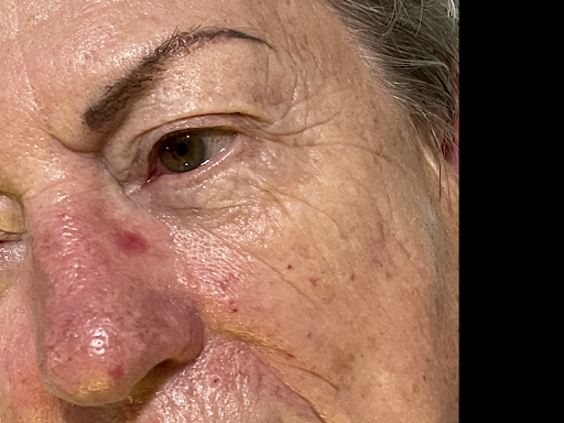 Explore tiki tattoo ideas, creative tattoo ideas in Victorville, available at Goawaytats tattoo removal