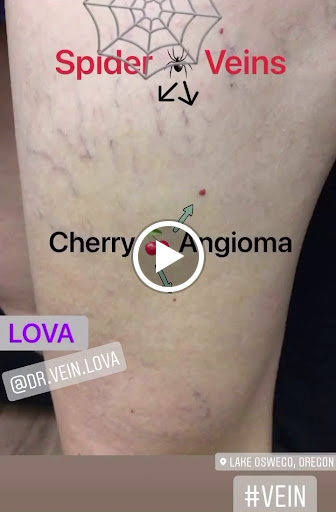 Explore tattoo ideas for mother of twins, creative tattoo ideas in Lake Oswego, available at Lake Oswego Vein and Aesthetic LOVA