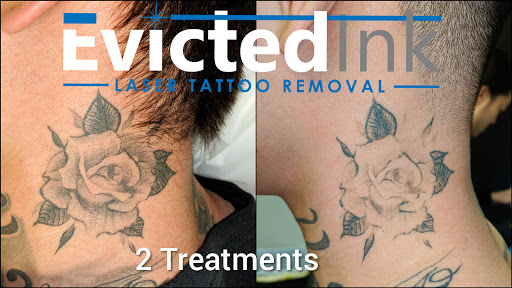 Explore warlock tattoo ideas, creative tattoo ideas in Wichita, available at Evicted Ink Laser Tattoo Removal