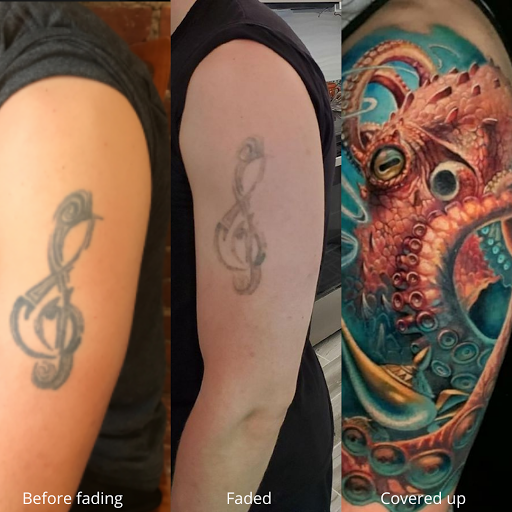 Explore sekiro tattoo ideas, creative tattoo ideas in Houston, available at Removery Tattoo Removal & Fading