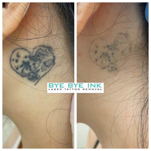 Explore rib tattoo ideas men, creative tattoo ideas in Middle Village, available at Bye Bye Ink Laser Tattoo Removal