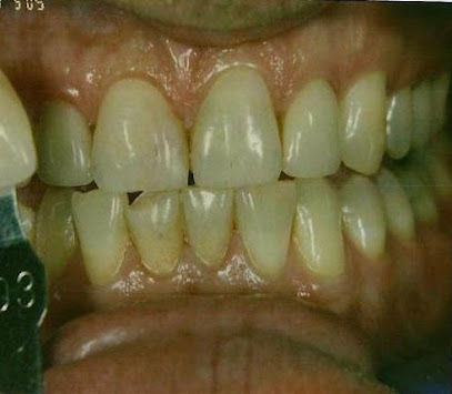 Teeth Whitening Auckland