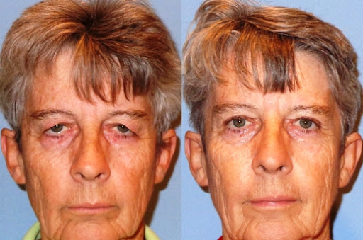 Plastic Surgeon «Arizona Eye Institute & Cosmetic Laser Center», reviews and photos, 19052 N R H Johnson Blvd, Sun City West, AZ 85375, USA