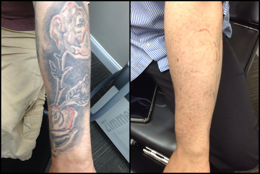 Explore cute ghost tattoo ideas, creative tattoo ideas in King Of Prussia, available at Inkaway Laser Tattoo Removal