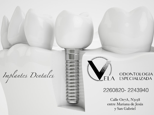 Opiniones de Vela Odontología Especializada en Quito - Dentista