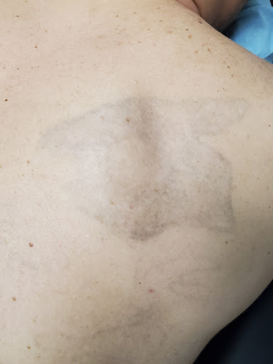 Explore flash tattoo ideas for men, creative tattoo ideas in Saint Paul, available at Fearless Tattoo Removal