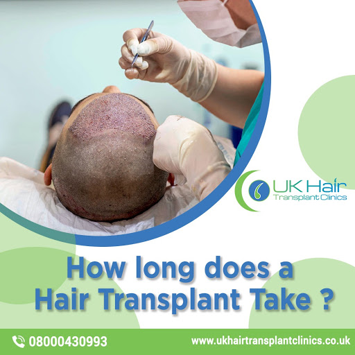 UK Hair Transplant Clinics