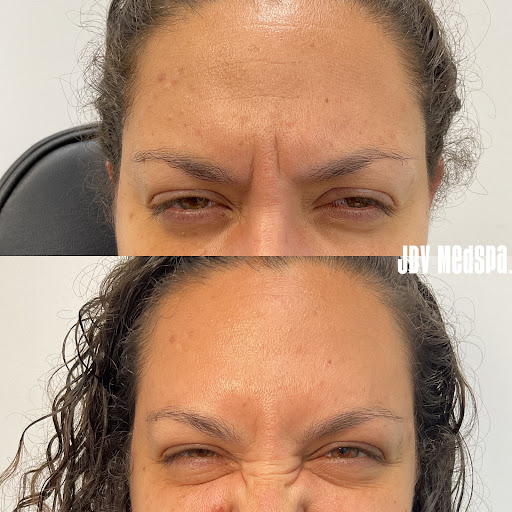 Explore viking chest tattoo ideas, creative tattoo ideas in Canton, available at JDV Med Spa