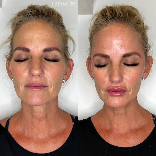 Skin Care Clinic «Ecobel Med Spa», reviews and photos, 2996 Grandview Ave NE #224, Atlanta, GA 30305, USA