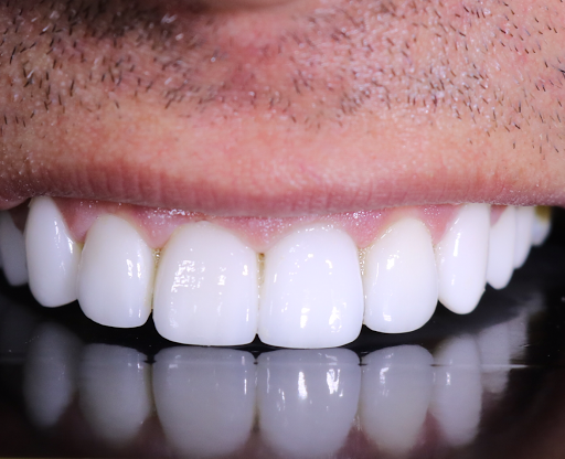Dental Experts Clinic Maadi