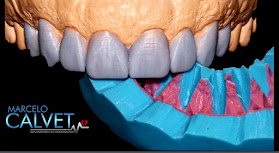 MARCELO CALVET - Odontologia e Implantodontia