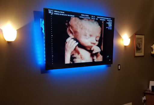 Fetal Vision Imaging