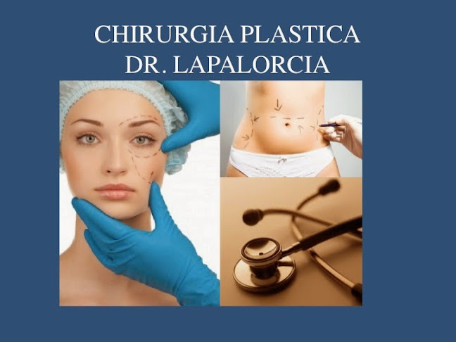 Recensioni di Dr. Luigi Maria Lapalorcia a Spoleto - Chirurgo plastico