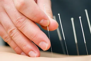 Natural Living Chiropractic & Acupuncture image