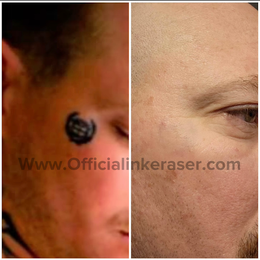 Explore ballerina tattoo ideas, creative tattoo ideas in Scottsdale, available at The INK Eraser