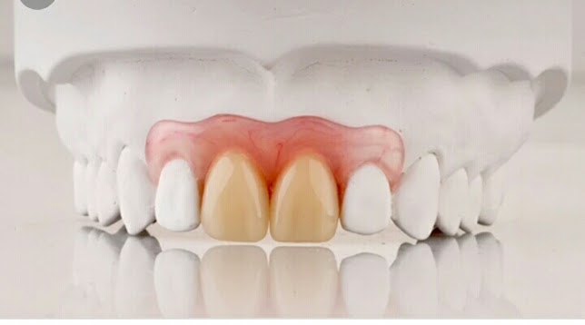 Opiniones de Dra.Isabel Gilces & tec. Dental Fernando Garay ( Clínica y laboratorio Dental vía Sonrisa) en Alto Hospicio - Dentista