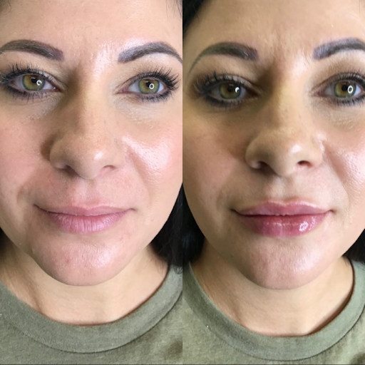 Explore tattoo cover up ideas for guys, creative tattoo ideas in Canton, available at JDV Med Spa