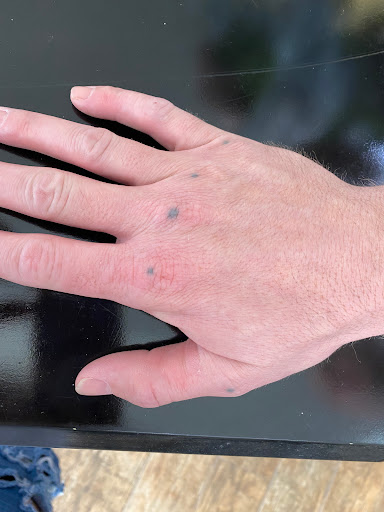 Explore calvin and hobbes tattoo ideas, creative tattoo ideas in Lake Jackson, available at Second Chance Laser Tattoo Removal