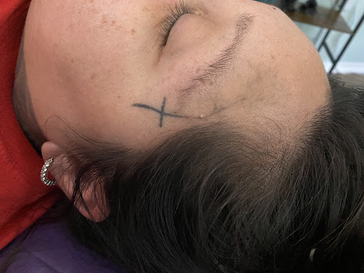 Explore pittsburgh steelers tattoo ideas, creative tattoo ideas in Lake Jackson, available at Second Chance Laser Tattoo Removal