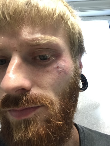 Explore luffy tattoo ideas, creative tattoo ideas in Chattanooga, available at Access Laser Center