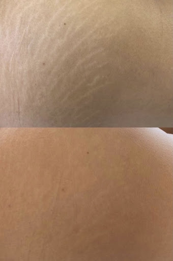 Explore small dragonfly tattoo ideas, creative tattoo ideas in Conroe, available at Institute 28